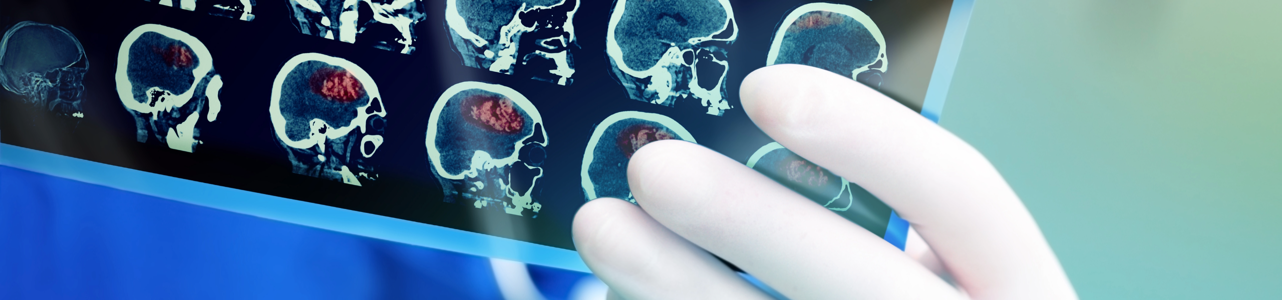xrays of a brain